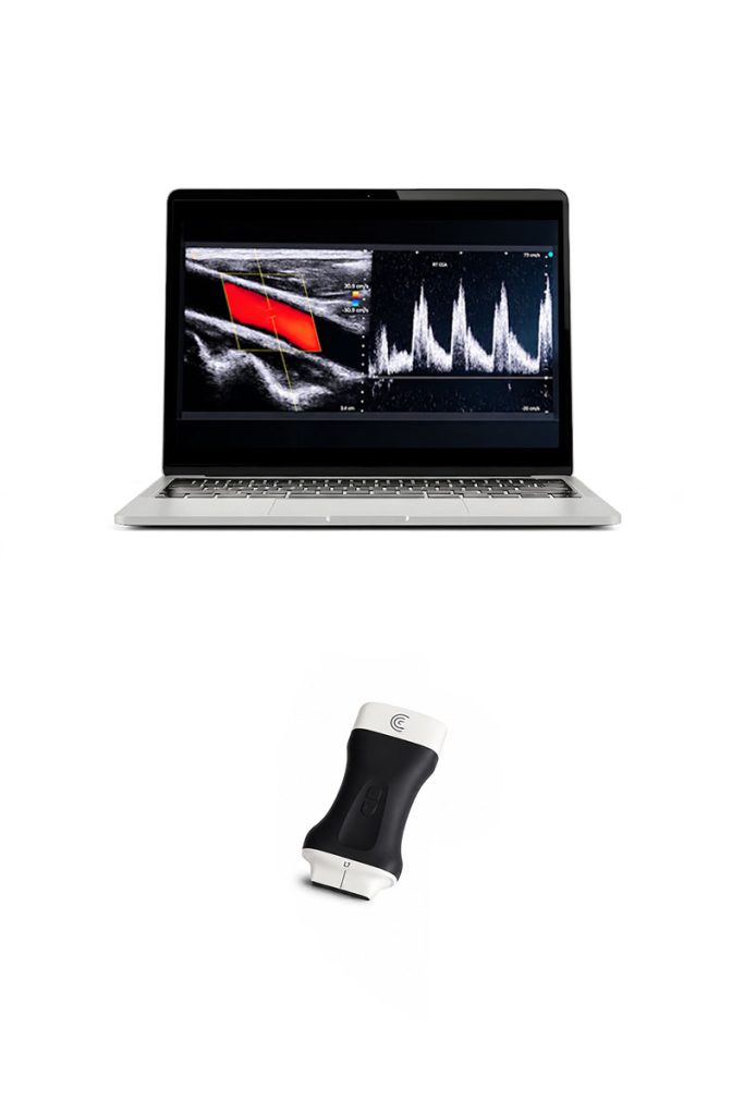 Clarius L7 HD3 - Ecografo wireless ad alta definizione per diagnostica vascolare carotidea e periferica